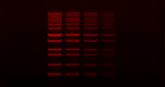 Elektroforez Görüntüleme Sistemi